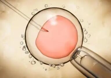 试管婴儿促排卵针怎么打才更有效做试管一般要打多少针
